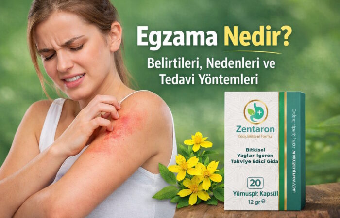 Egzama Nedir? Belirtileri, Nedenleri ve En Etkili Tedavi Yöntemleri