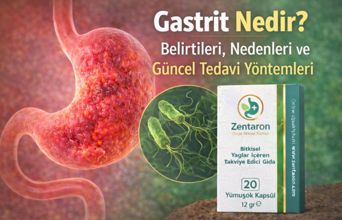 Gastrit Nedir? Belirtileri, Nedenleri ve Güncel Tedavi Yöntemleri