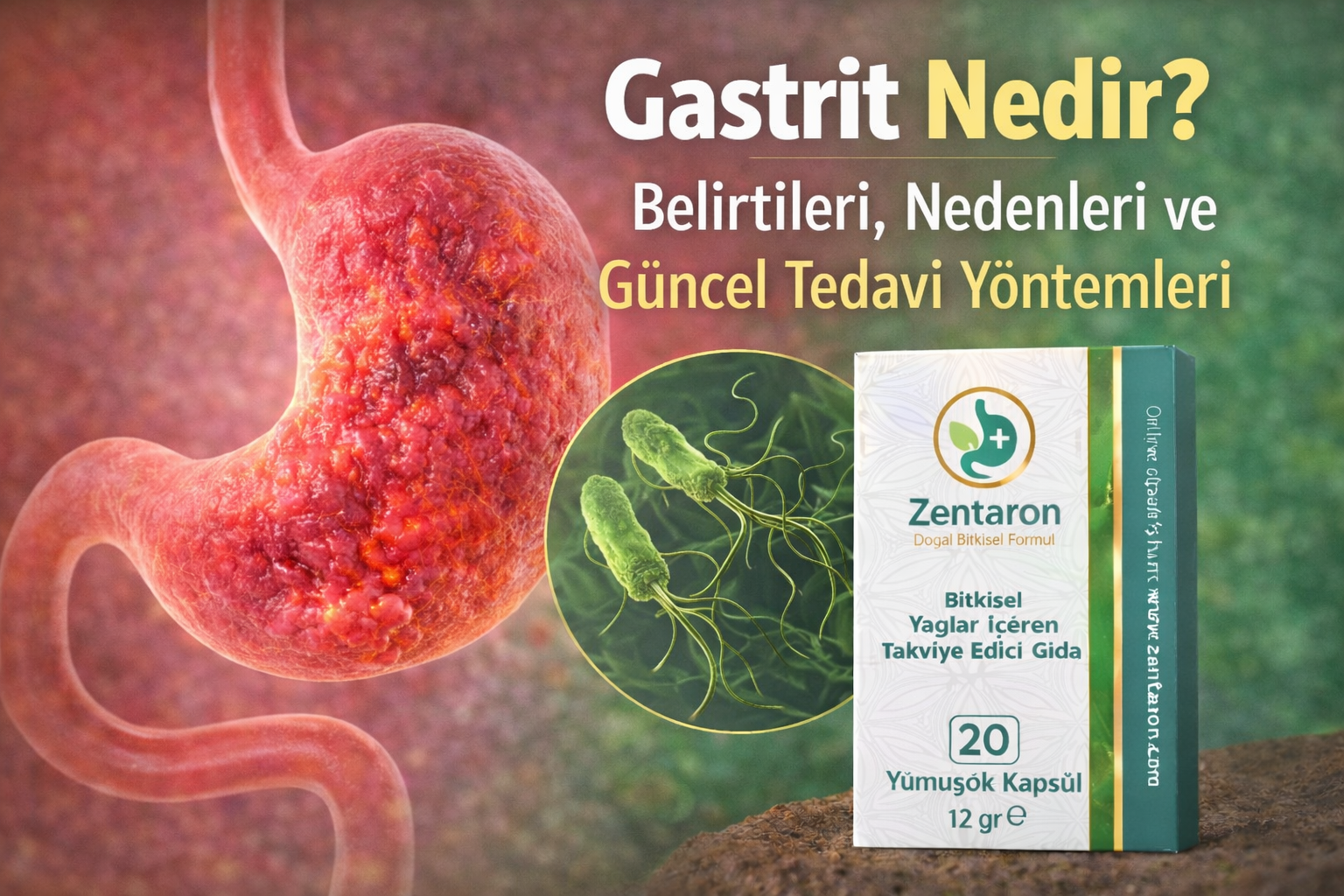Gastrit Nedir? Belirtileri, Nedenleri ve Güncel Tedavi Yöntemleri