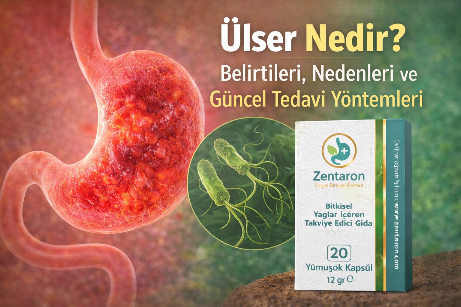 Ülser Nedir? Belirtileri, Nedenleri ve Güncel Tedavi Yöntemleri